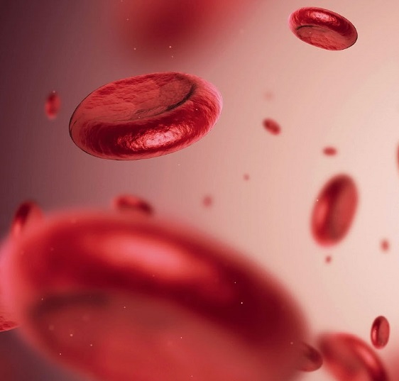 anaemia a common but misunderstood condition