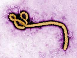 ebola virus disease